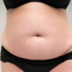 Scar Camouflage Treatment in Dubai: Natural, Long-Lasting Results