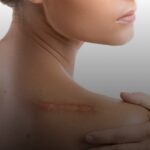 Blepharoplasty Malaysia: Precision, Confidence, Natural Results