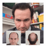 A Fresh Confidence: A Personal Journey with