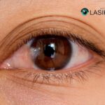 Pterygium Eyedrops: Gentle Relief for Irritated Eyes