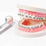 Invisalign Estimate: Clear, Friendly Pricing & Timelines