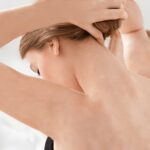 Vitiligo Patch Blending Treatment: Natural Camouflage Solutions