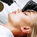 Microneedling Montreal: Revitalise Your Skin with Expert Care