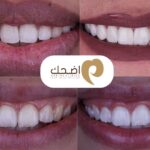 أفضل دكتور تجميل أسنان: خبرة موثوقة وابتسامة مثالية